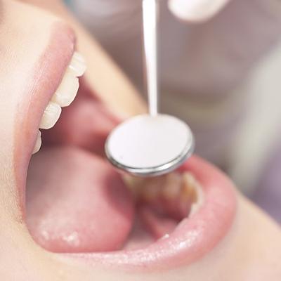Accessori per Protesi e apparecchi ortodontici